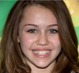 Miley Cyrus before smile makeover
