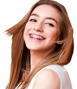 teenager smiling with braces